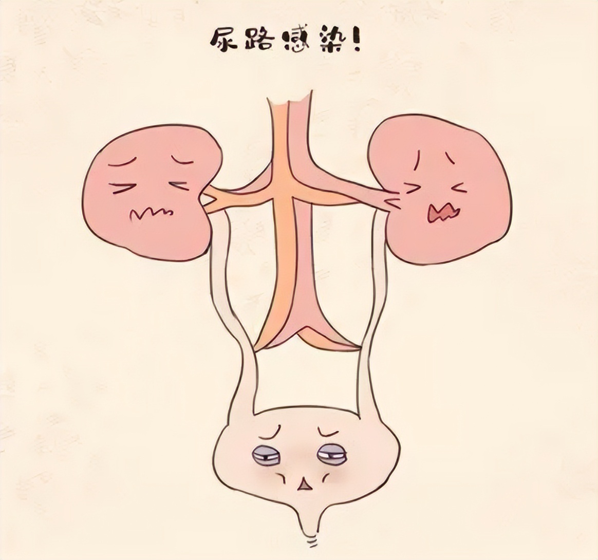 不想被反复折磨,尿路感染最简单的自愈方法