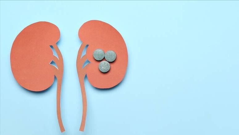 腰痛有可能是结核炎症引起的吗,肾结石腰疼伴有血尿是怎么回事