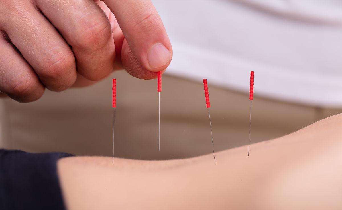 中医针灸治疗腰痛病的学术思想,古法针灸临床治验