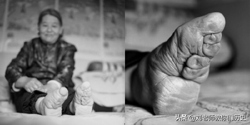 历史上什么朝代开始裹小脚,古代裹小脚的真实目的是什么