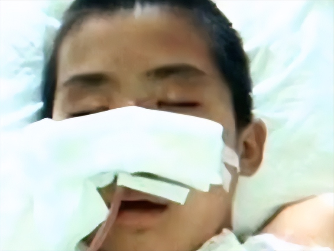 山东13岁男孩体内被打入高压气体,山东男孩被充气后续