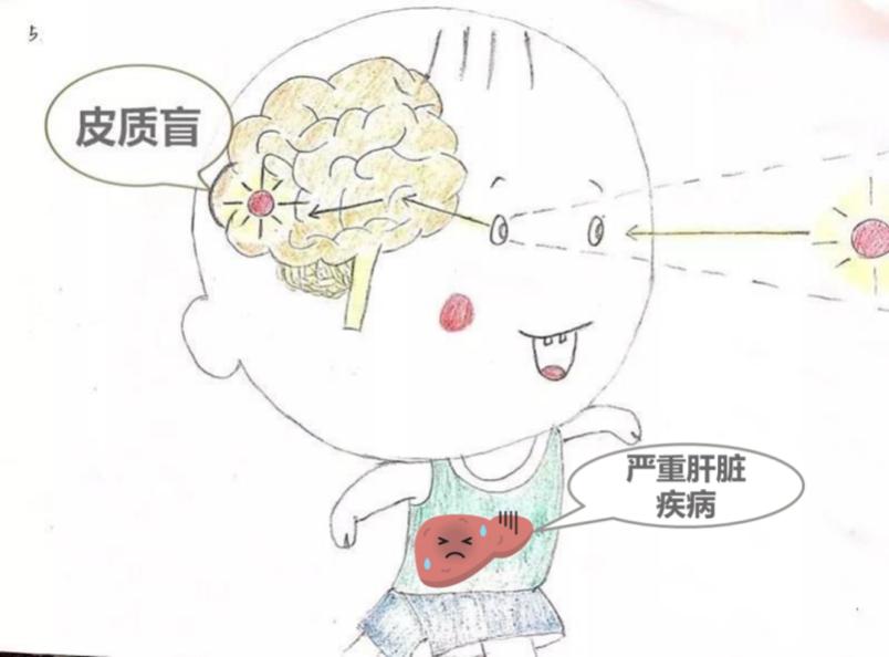 各种检查查不出来的肝病,有查不出原因的肝病吗