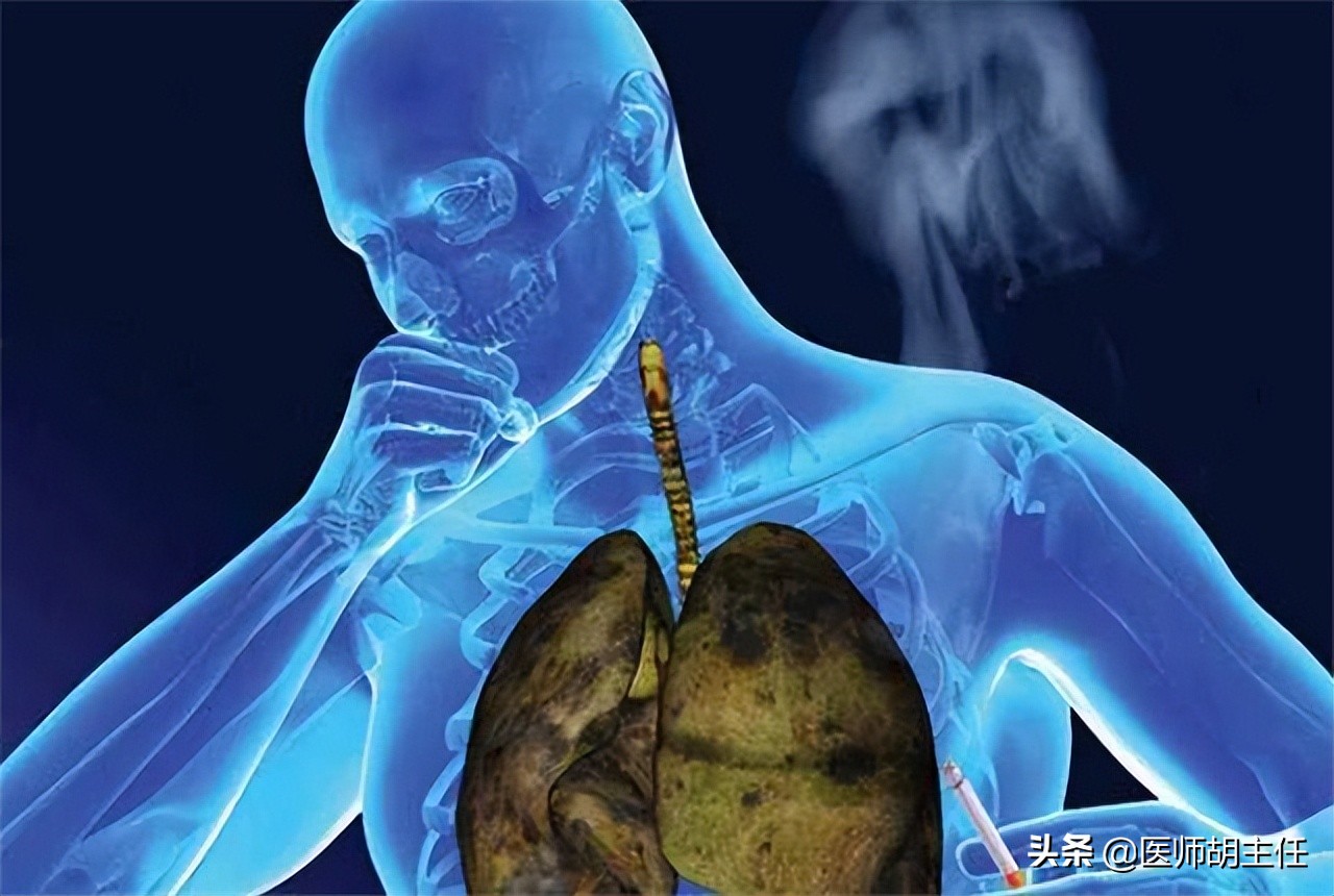 肺癌导致的肩膀疼是什么症状,肺癌导致肩膀疼痛的症状