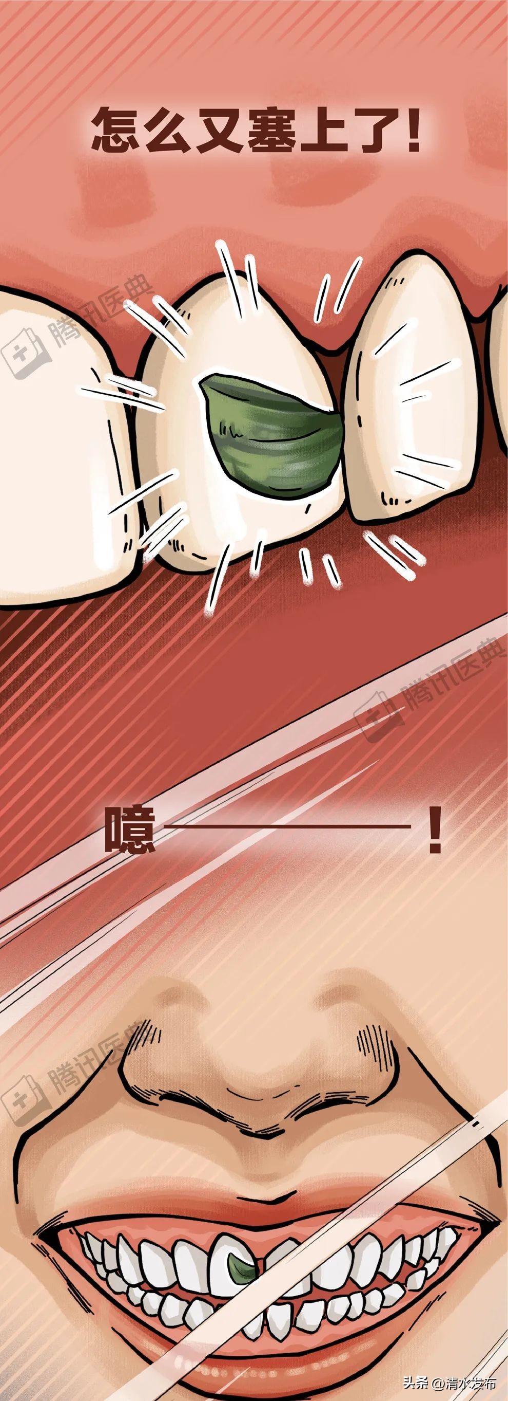 两边大牙一吃肉就塞牙如何修复,14岁学生吃肉老是塞牙需要矫正吗