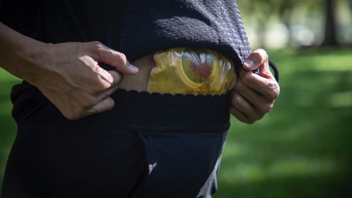 没有大便肛门却流血要怎么治疗,正常人怎么排便