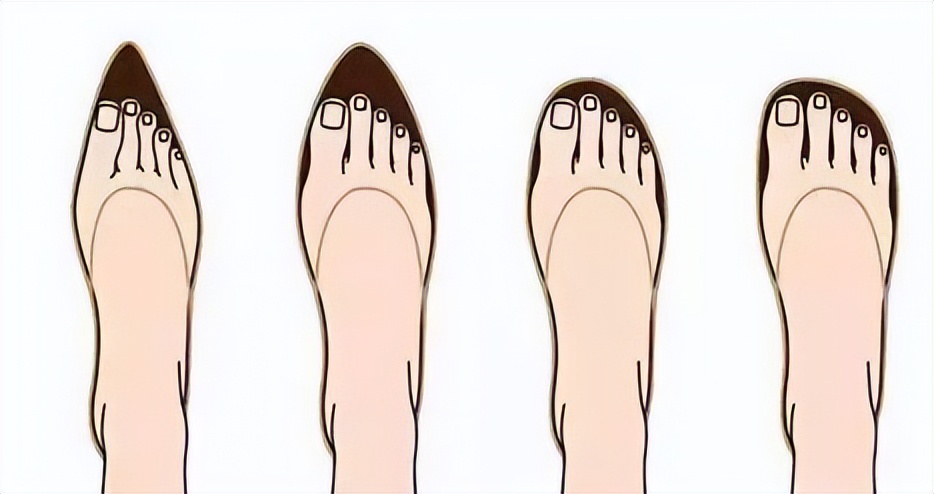 拇趾外翻注意事项,拇外翻要注意哪些事项