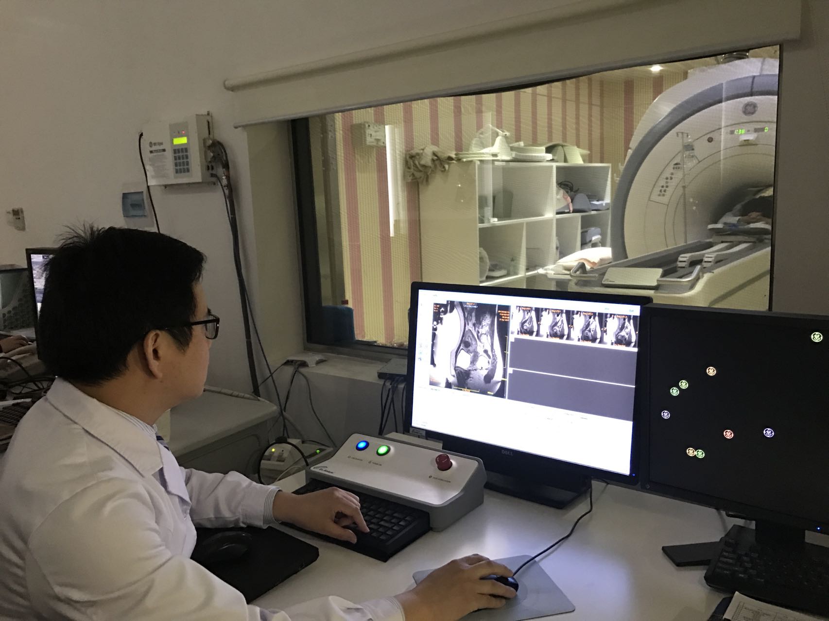 漯河治疗子宫肌瘤最好,齐鲁医院治疗子宫肌瘤最好的专家