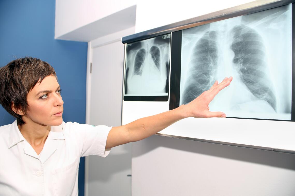 肺部感染需要隔离几天,反复感染肺炎肺部能修复吗