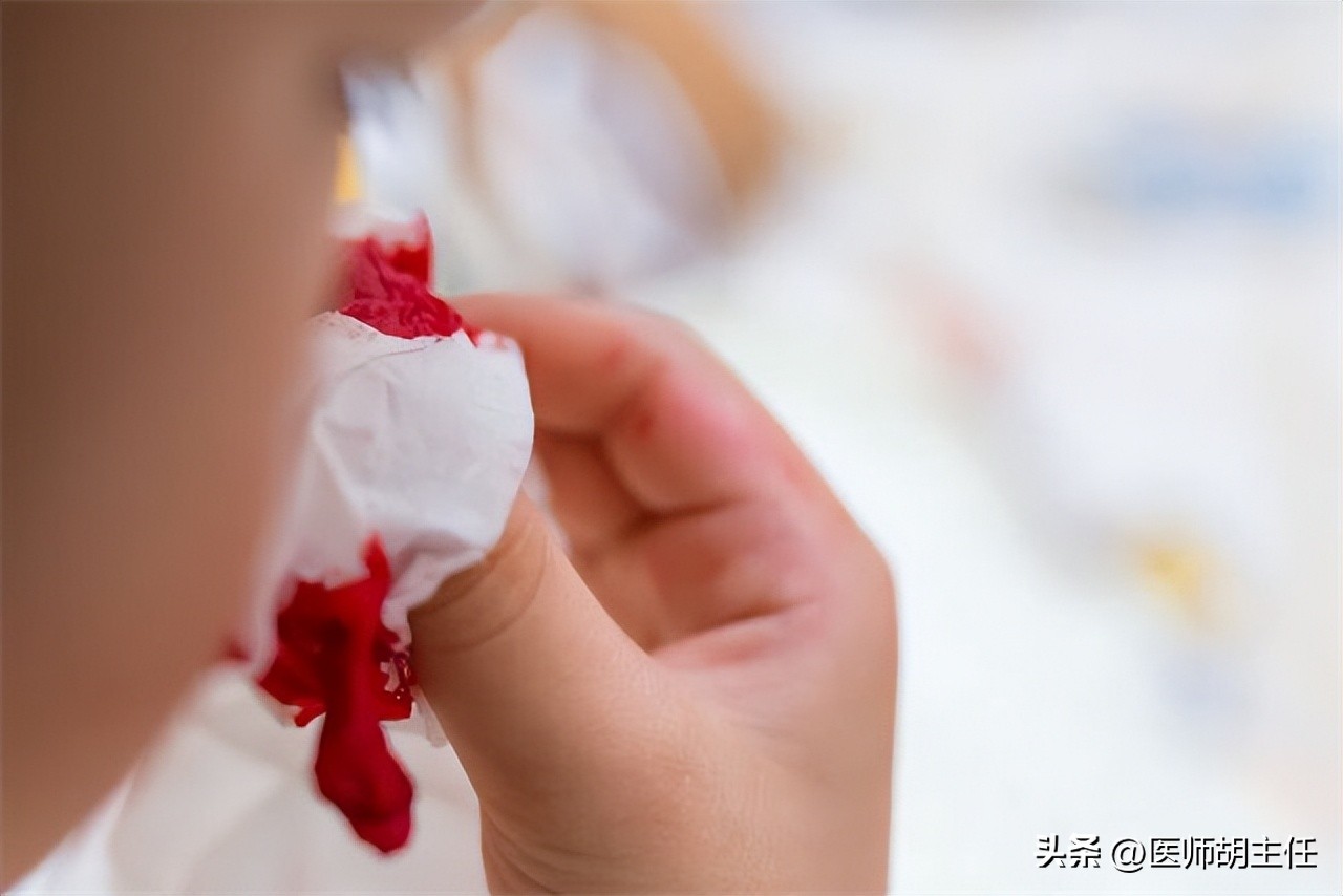 45岁男子查出鼻咽癌，已做5次化疗！医生：这些症状别当成鼻炎