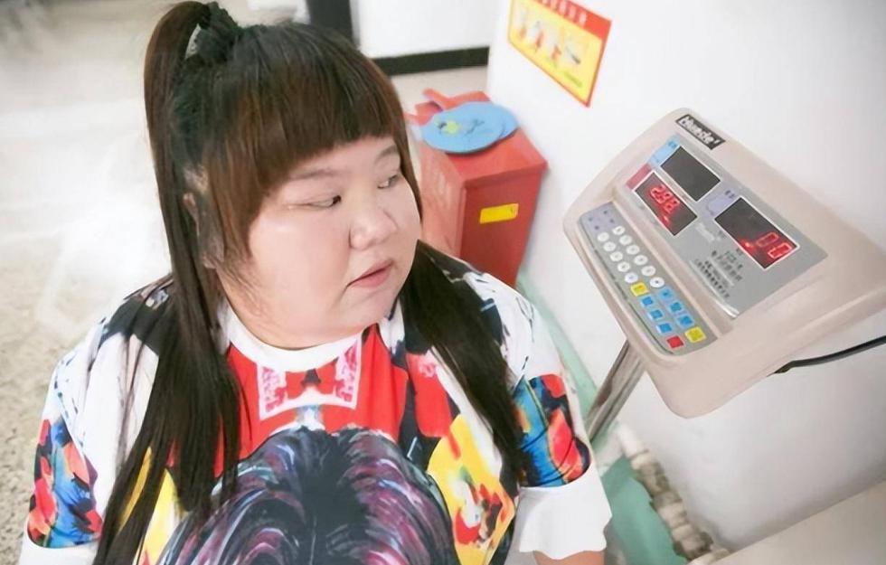 当年校花被丈夫养胖三百多斤,结婚3年校花被丈夫喂胖到332斤
