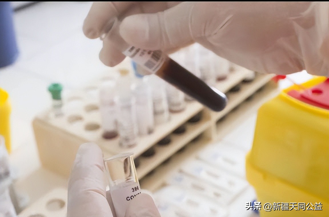 泰国艾滋病患者的真实生活,泰国曼谷艾滋病很严重吗