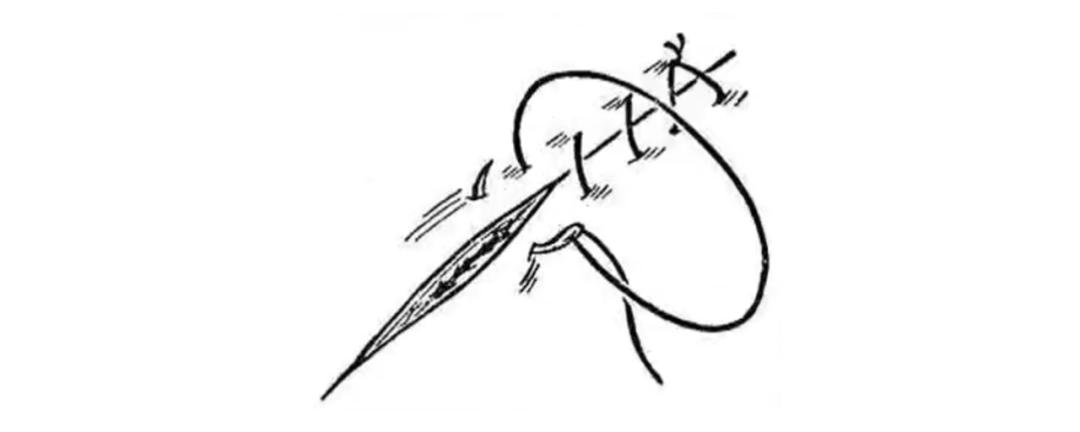 外科各种缝合方法的适用情况,外科操作缝合