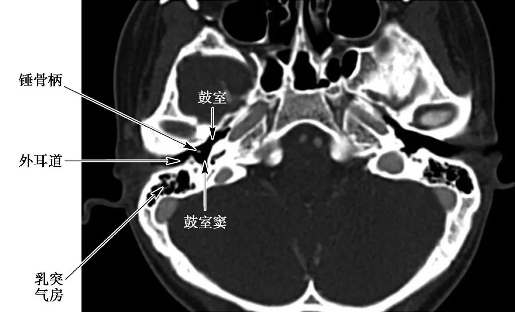 耳部解剖结构和生理功能,耳部解剖笔记