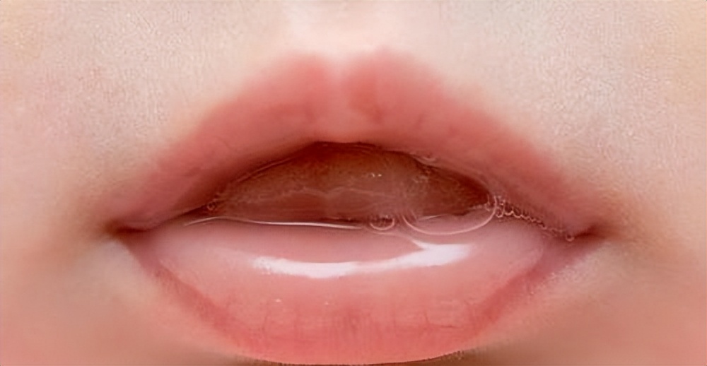 聪明的父母怎么处理宝宝流口水，快看这几个步骤