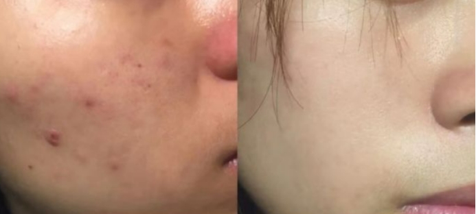 混合性皮肤水乳推荐孕妇可用,水乳推荐排行榜10强抗老孕妇