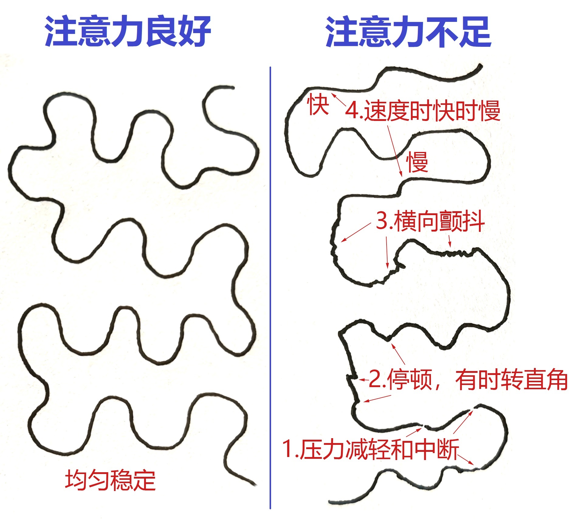 总是走神心理,上课走神发呆注意力不集中怎么办
