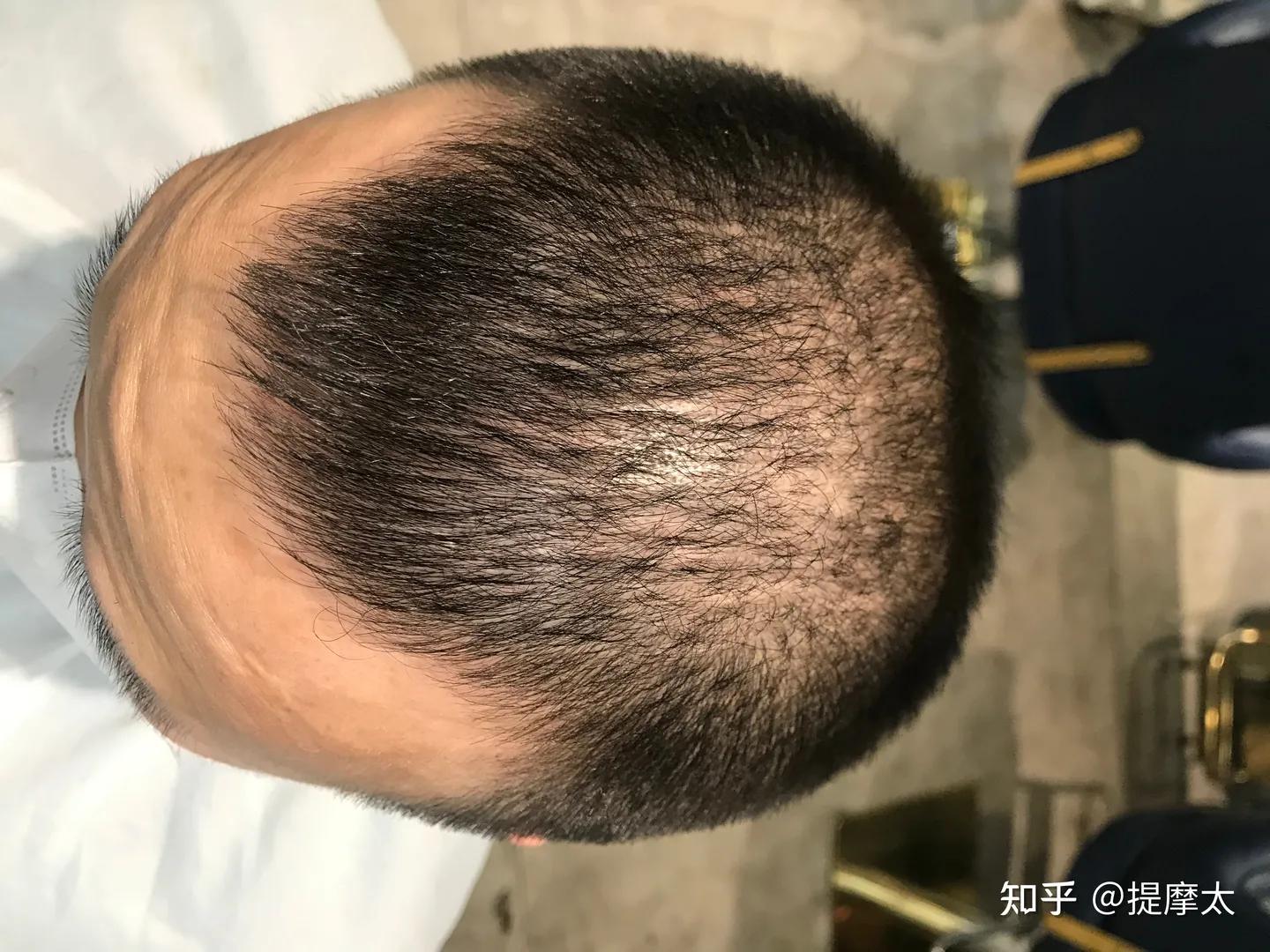 揭密新型骗局是真的吗,揭秘骗局背后的真相