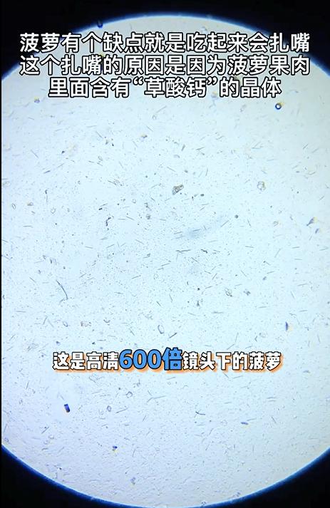 吃菠萝嘴巴舌头刺痛怎么办,吃菠萝嘴扎了很疼怎么办