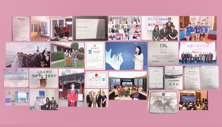 不拔牙矫正嘴凸下巴后缩案例,嘴瘪不拔牙矫正嘴会凸怎么办