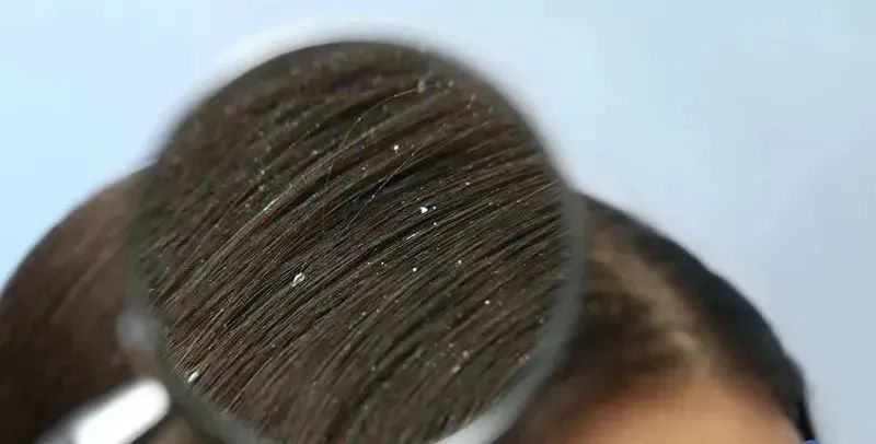 淘米水让白发变黑发吗,淘米水洗发水真的能让白发变黑吗