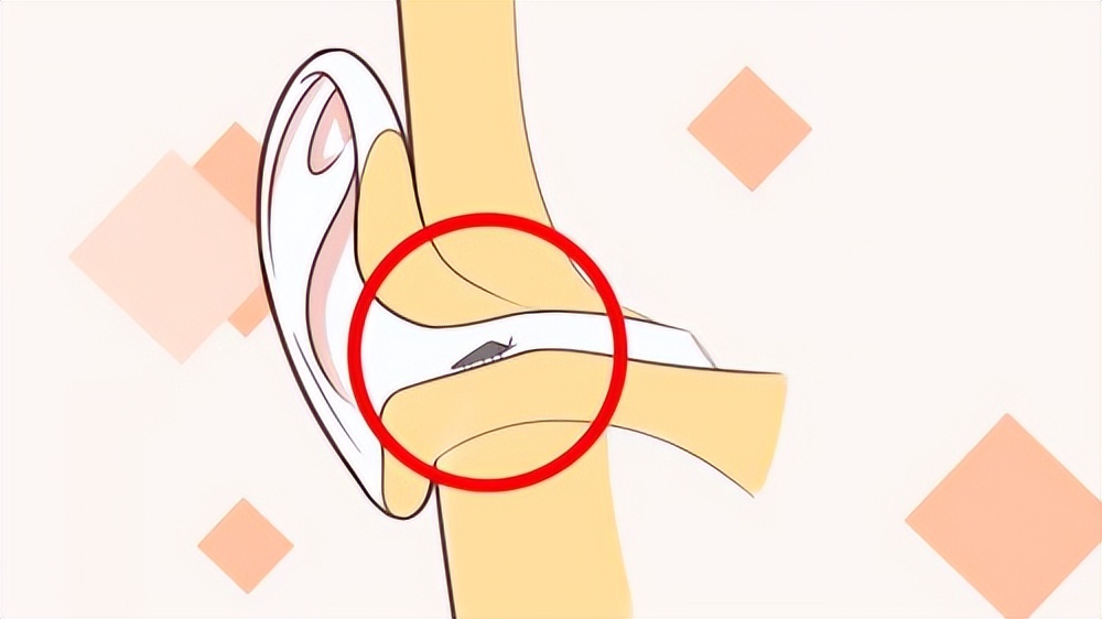 耳朵痒却掏不出任何东西中医辨证,耳朵特别痒又掏不出耳屎怎么办