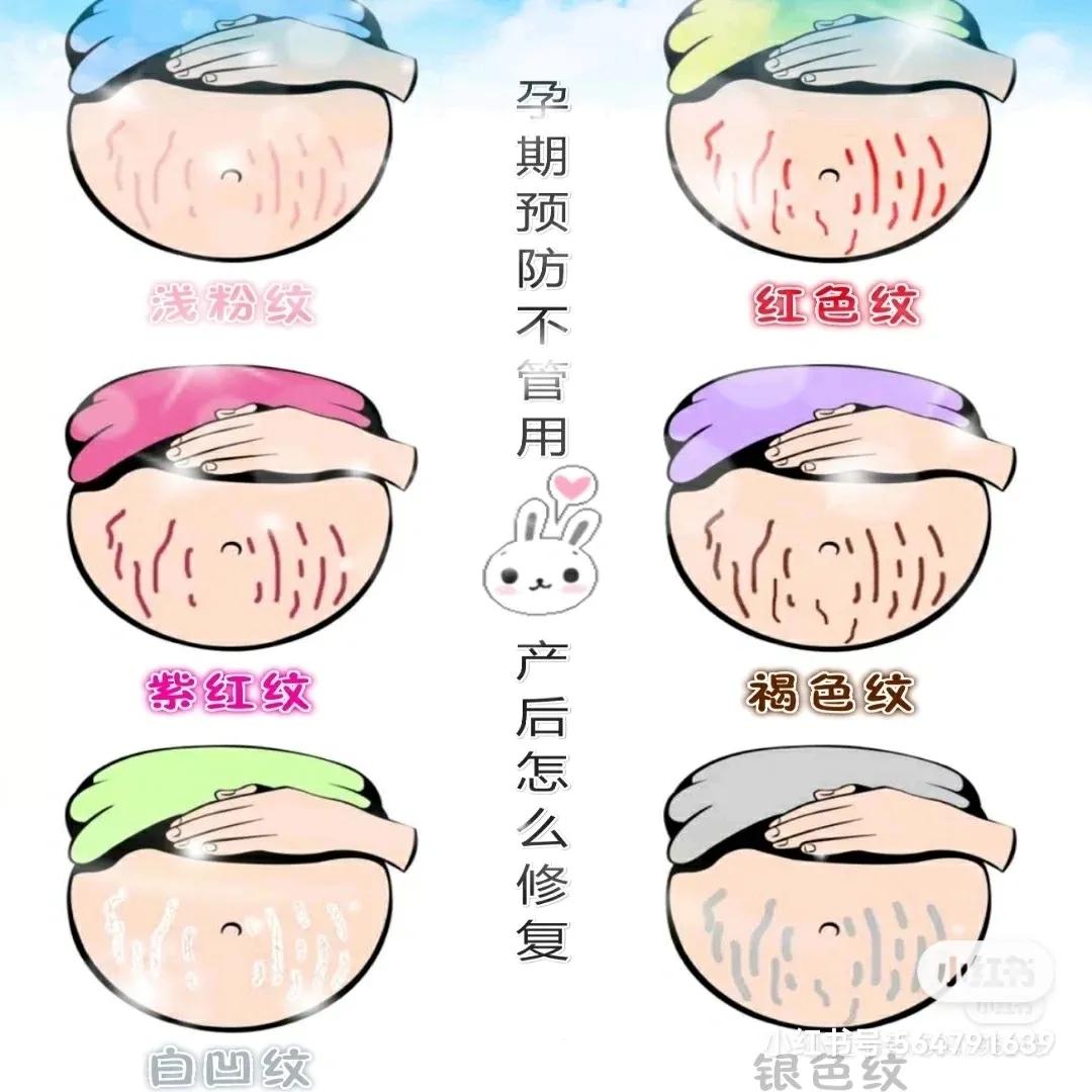 孕早期预防长妊娠纹的妊娠油推荐,葡萄籽油可以预防妊娠纹吗