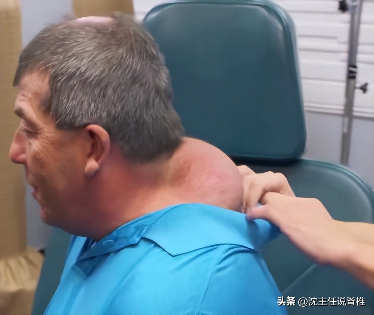 脖子后面与肩膀连接处的富贵包,脖子后面颈椎上的富贵包怎样消除