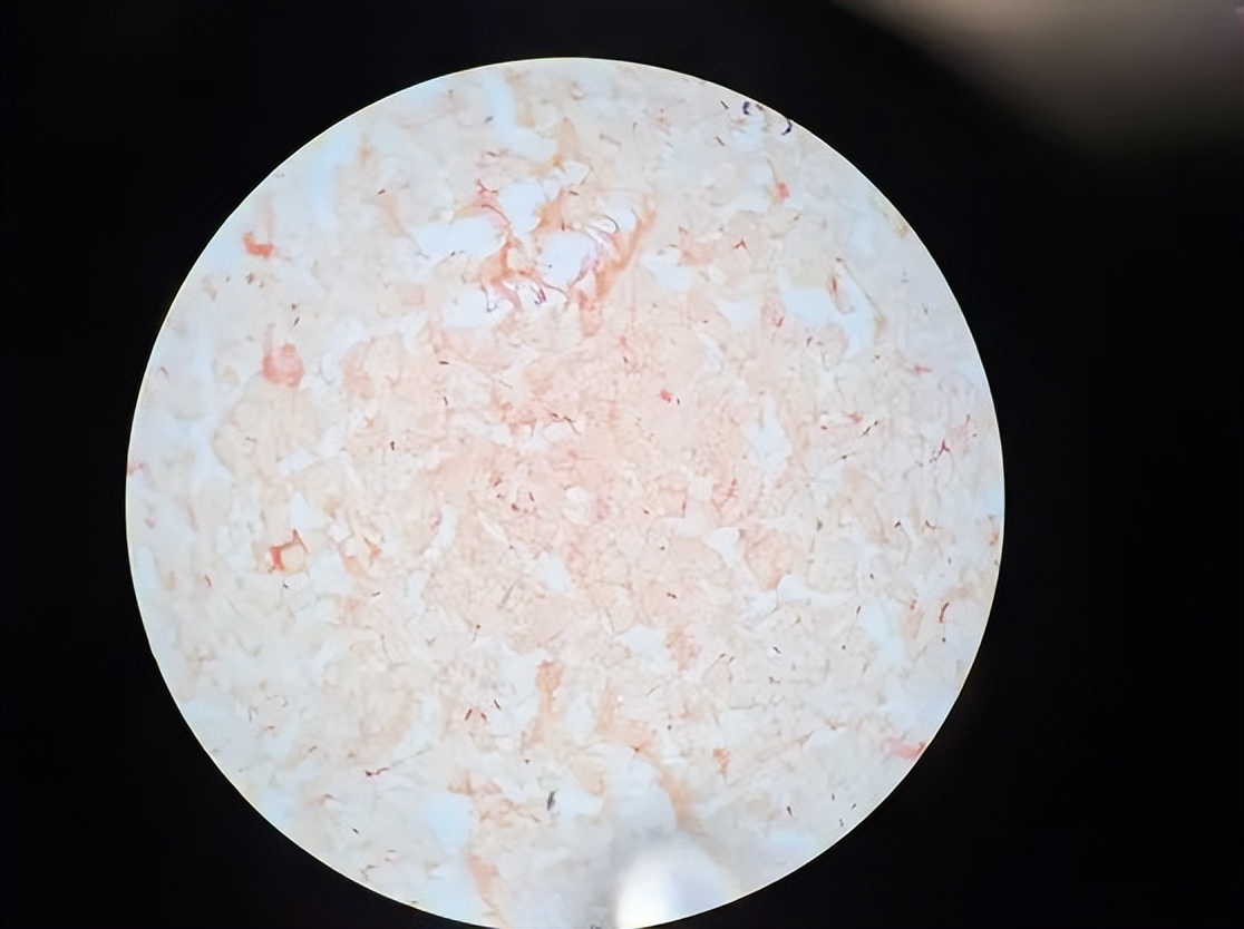 Pantoea,泛菌属——肠道内善恶兼备的神秘细菌