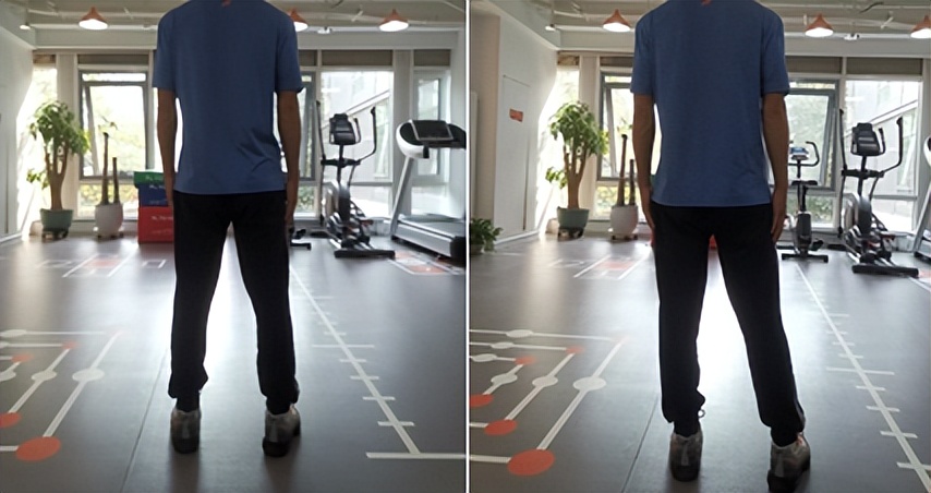 踝关节韧带重建后的最佳锻炼方法,冉冉跟腱康复