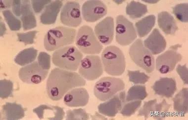 巴西布兰格斯牛和内洛尔牛中,探索双叉巴贝虫和蜱虫的季节性波动