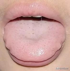 肝不好，人易倒，肝不好有这5种表现，教你5种中成药，养肝调肝