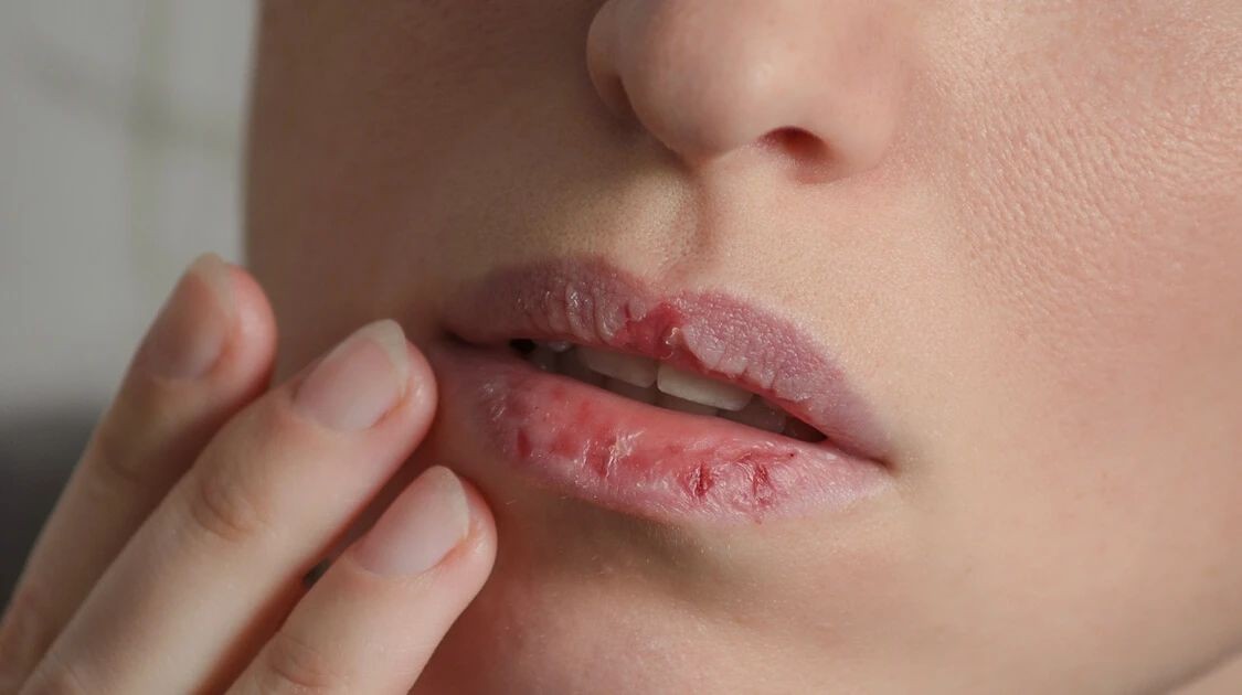 秋冬唇部拔干、起皮，到底怎么涂口红才不会干？