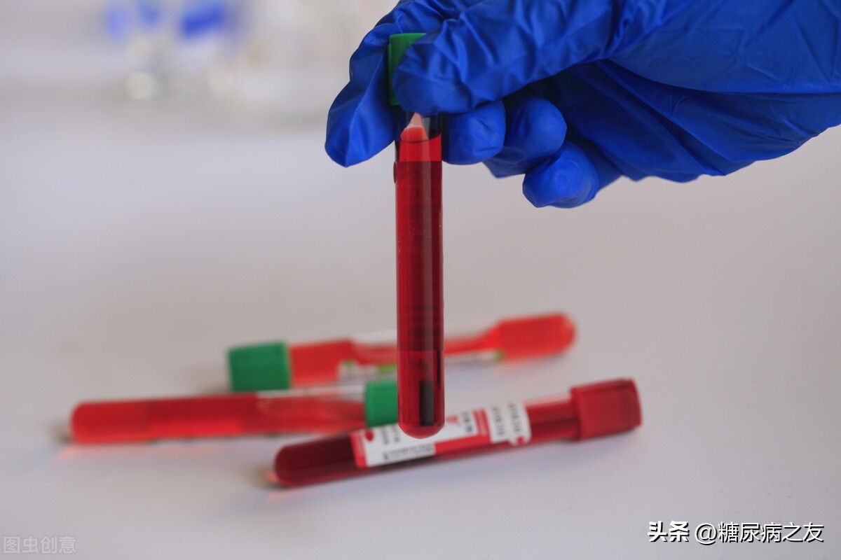 糖化血红蛋白你了解多少,糖化血红蛋白怎么能把它降下去