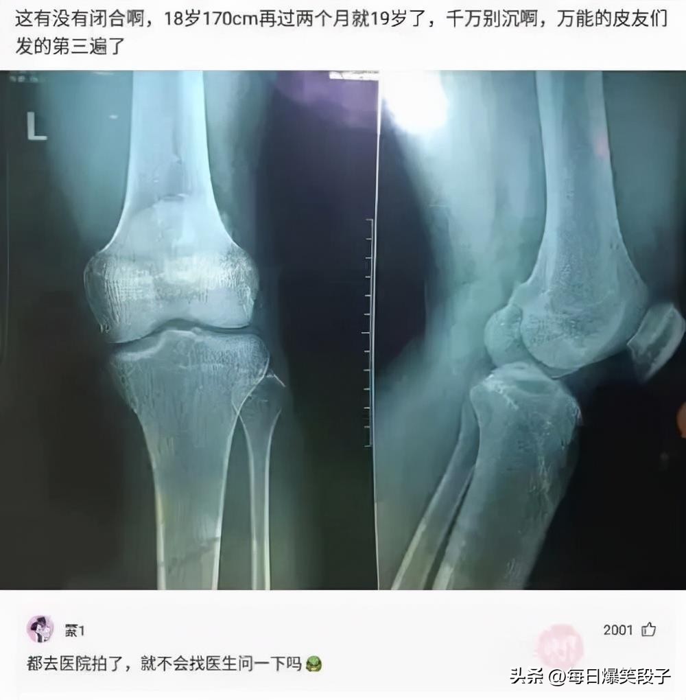 听我说谢谢你搞笑段子,谢谢你来了爆笑段子