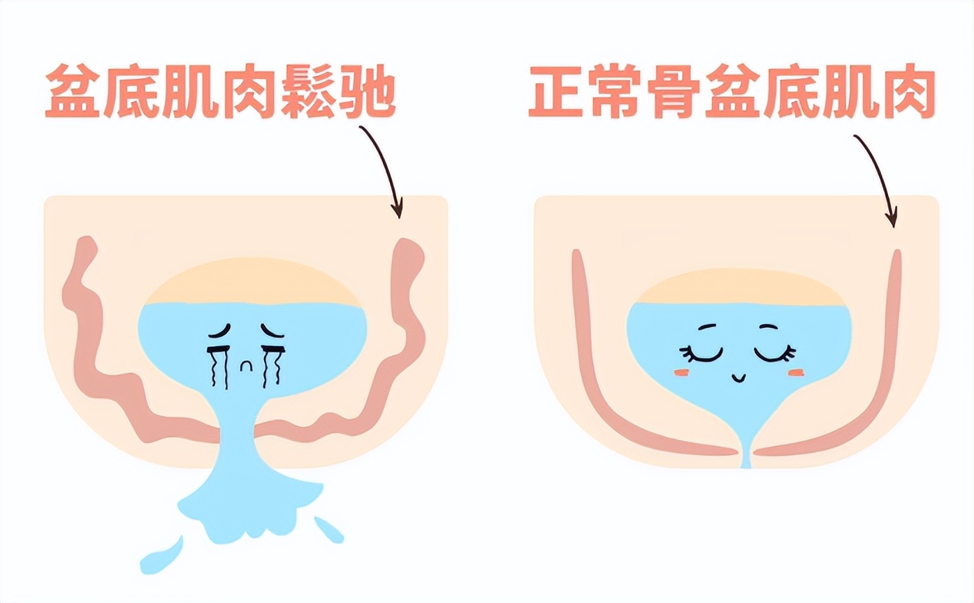 产后修复指南：宝妈产后也能恢复如初，自信迎接新的阶段