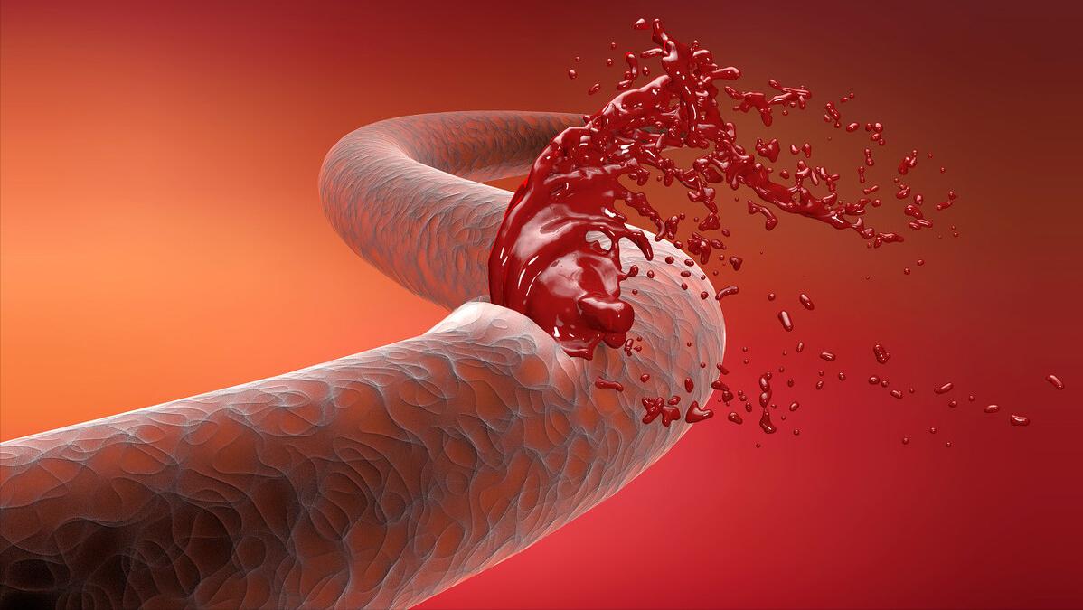 女性间歇出血怎么回事,女性出血的原因及解决方法