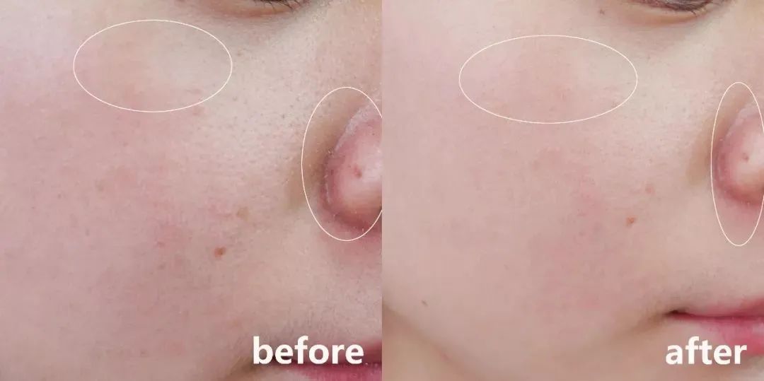 雪花秀滋阴水乳补水效果怎么样,韩国雪花秀补水祛黄3件套