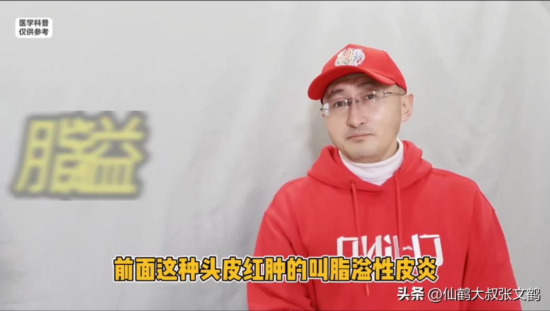 头皮屑的快速应急方法,头皮屑最有效的解决方法