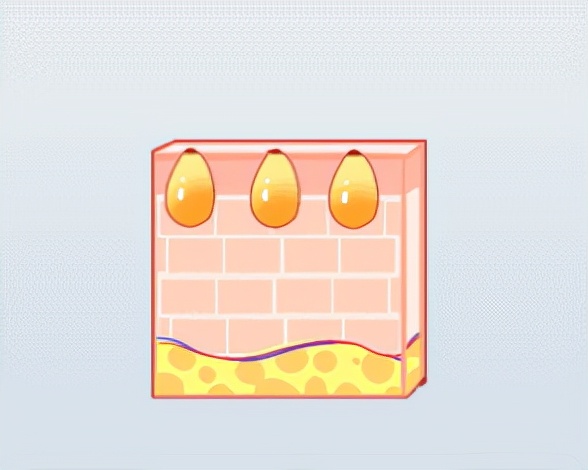 问题肌36计:4大级别痘痘如何对抗你知道吗?调理代谢很重要