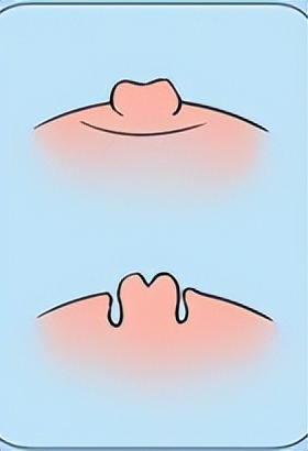 女生胸部上长了白色小点点,女生胸部长了好多小红点疙瘩