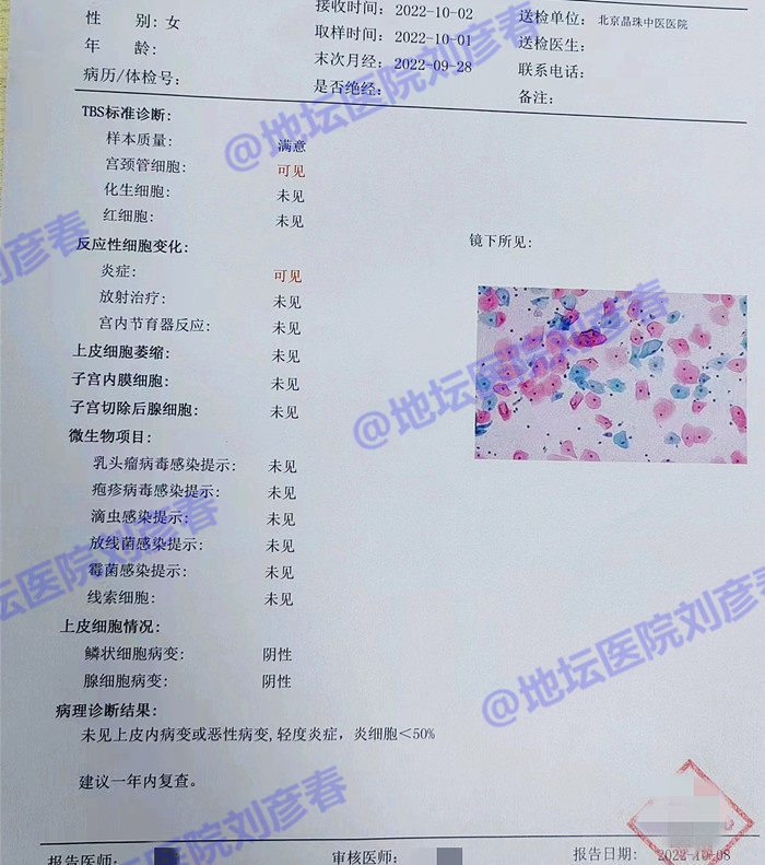 怎么治疗hpv宫颈糜烂,hpv感染到宫颈病变需要多久
