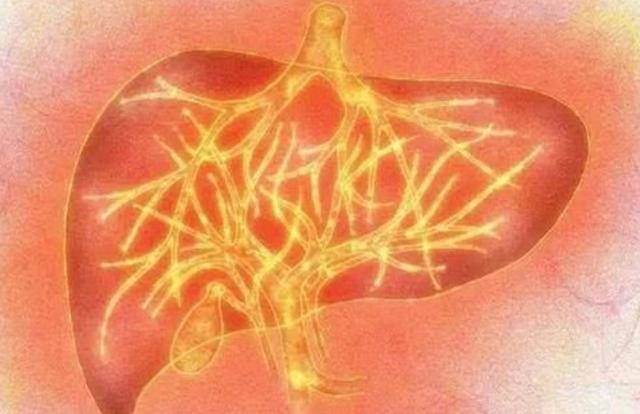 有肝火入睡难,如何判断胃火还是肝火导致失眠