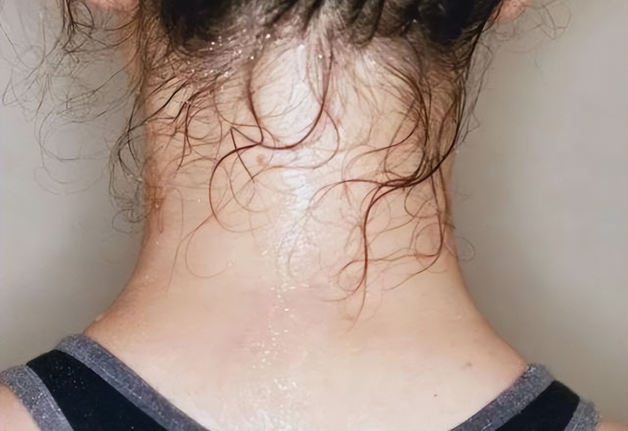 快速补充钾元素的食物,补充钾元素的食物有哪些