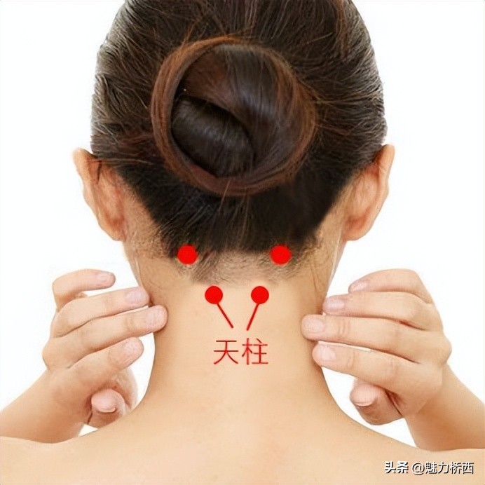 阳康之后头痛怎么办,阳康之后一直头疼是怎么回事