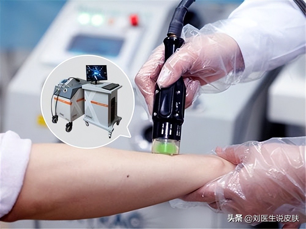 白癜风怎么彻底治愈,白癜风怎么快速治