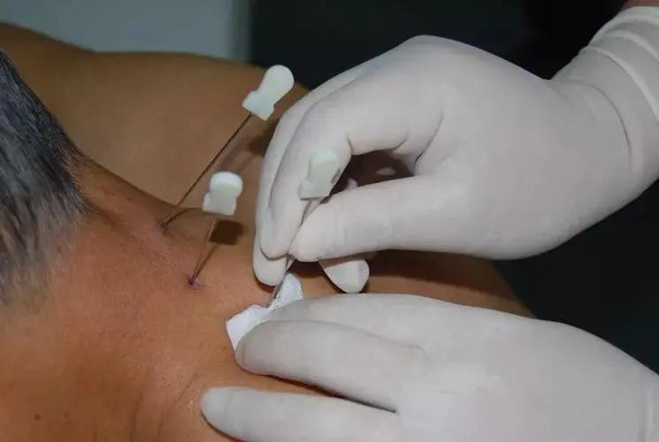 胸椎正骨推拿手法,中医胸椎推拿手法全套教程