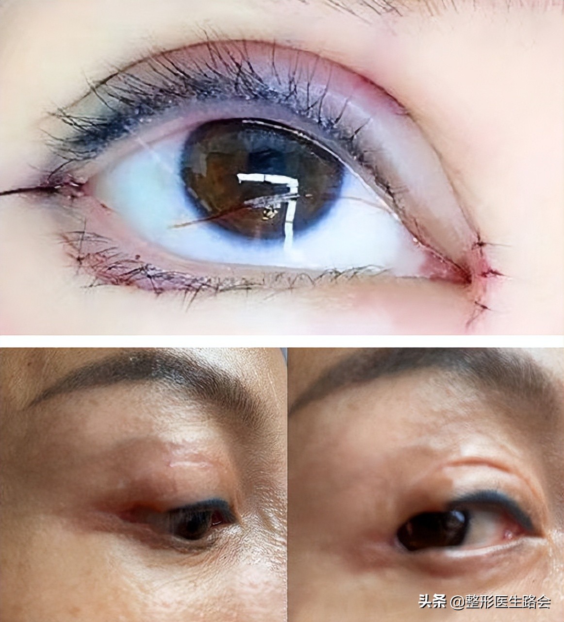 为什么医生不建议去三甲医院,三甲医院医生不建议做手术