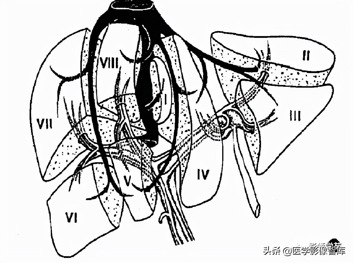 肝脏影像分叶分段解剖图,肝脏分段解剖图谱