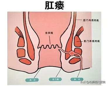 大便时肛门疼痛怎么治疗,大便肛门疼痛用什么药好得快