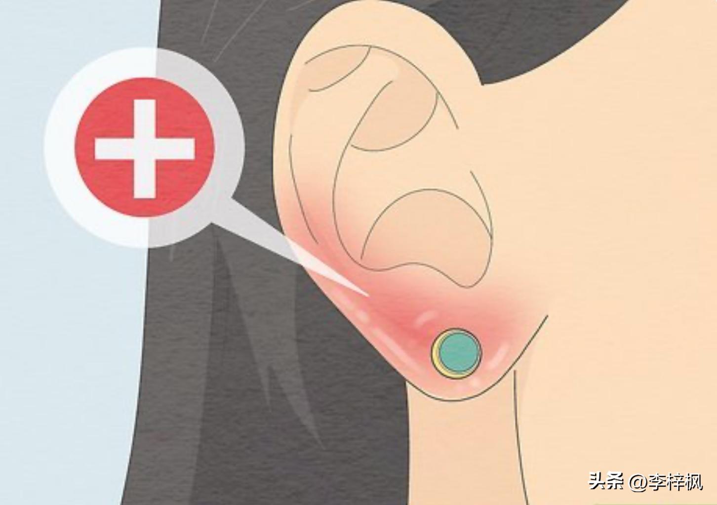 耳洞臭臭的怎么整啊,耳洞臭臭的是什么原因